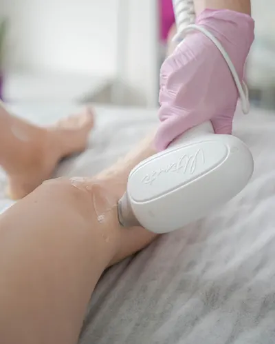 Laser Estetics Łódź